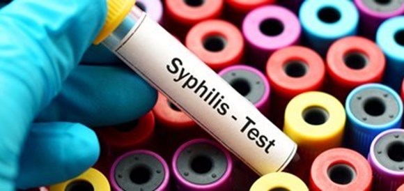בדיקת נוגדנים לעגבת (Syphilis Antibodies) - תמונה